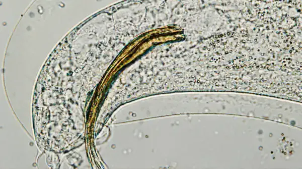 lungworm