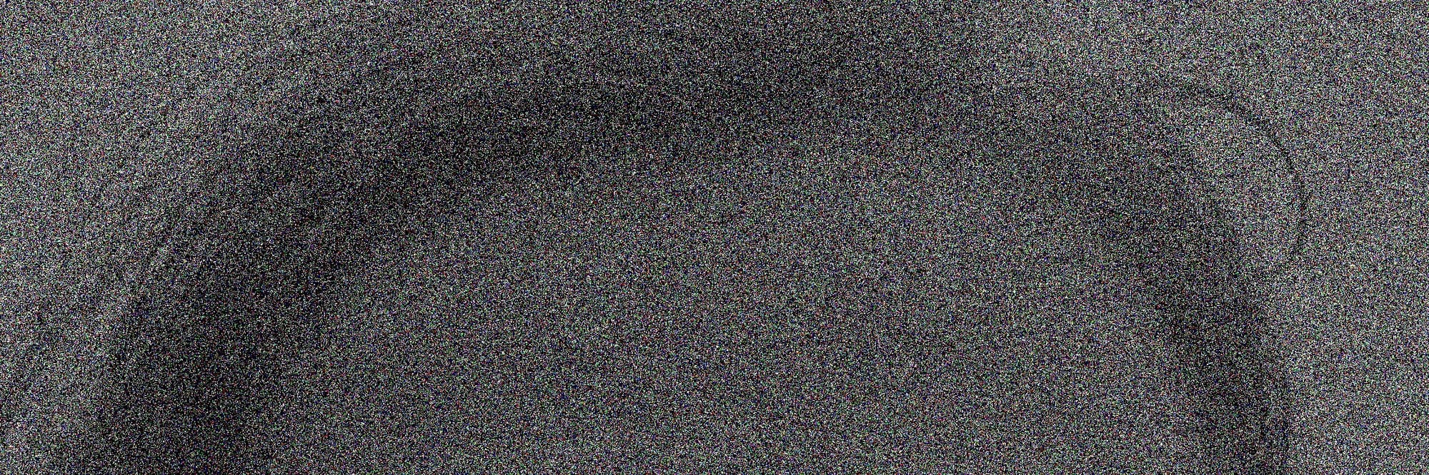 A very noisy image of my forehead
