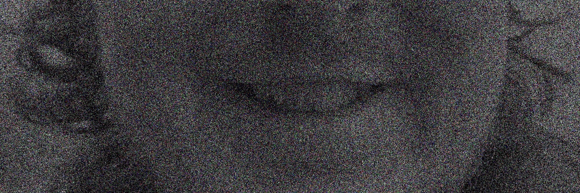A very noisy image of my mouth, smiling with a lot of teeth.