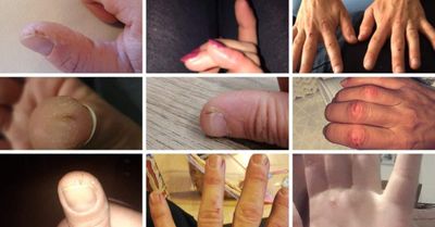 Comment lutter contre les mains sèches quand on travaille en grande distribution