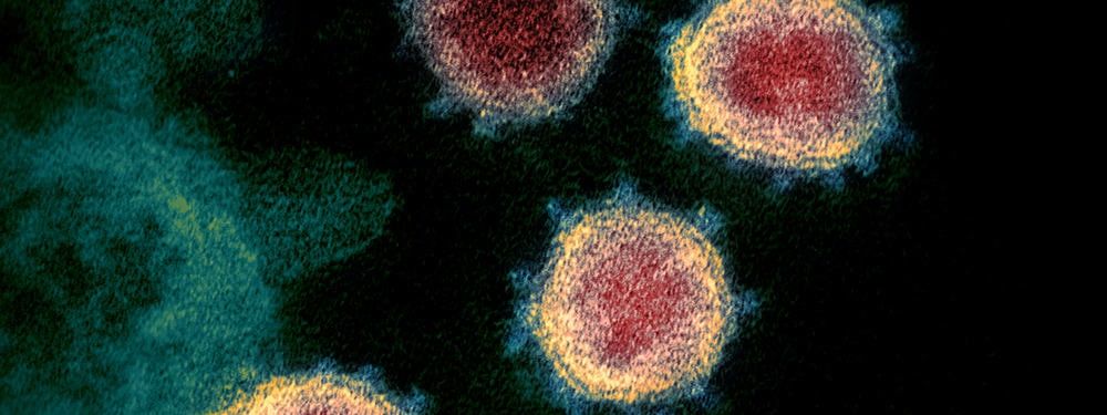 The microscopic view of the virus which causes Coronavirus disease