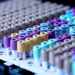 OpenAI's nonprofit is funding scientific datasets for medical AI, including files from failed drug companies
