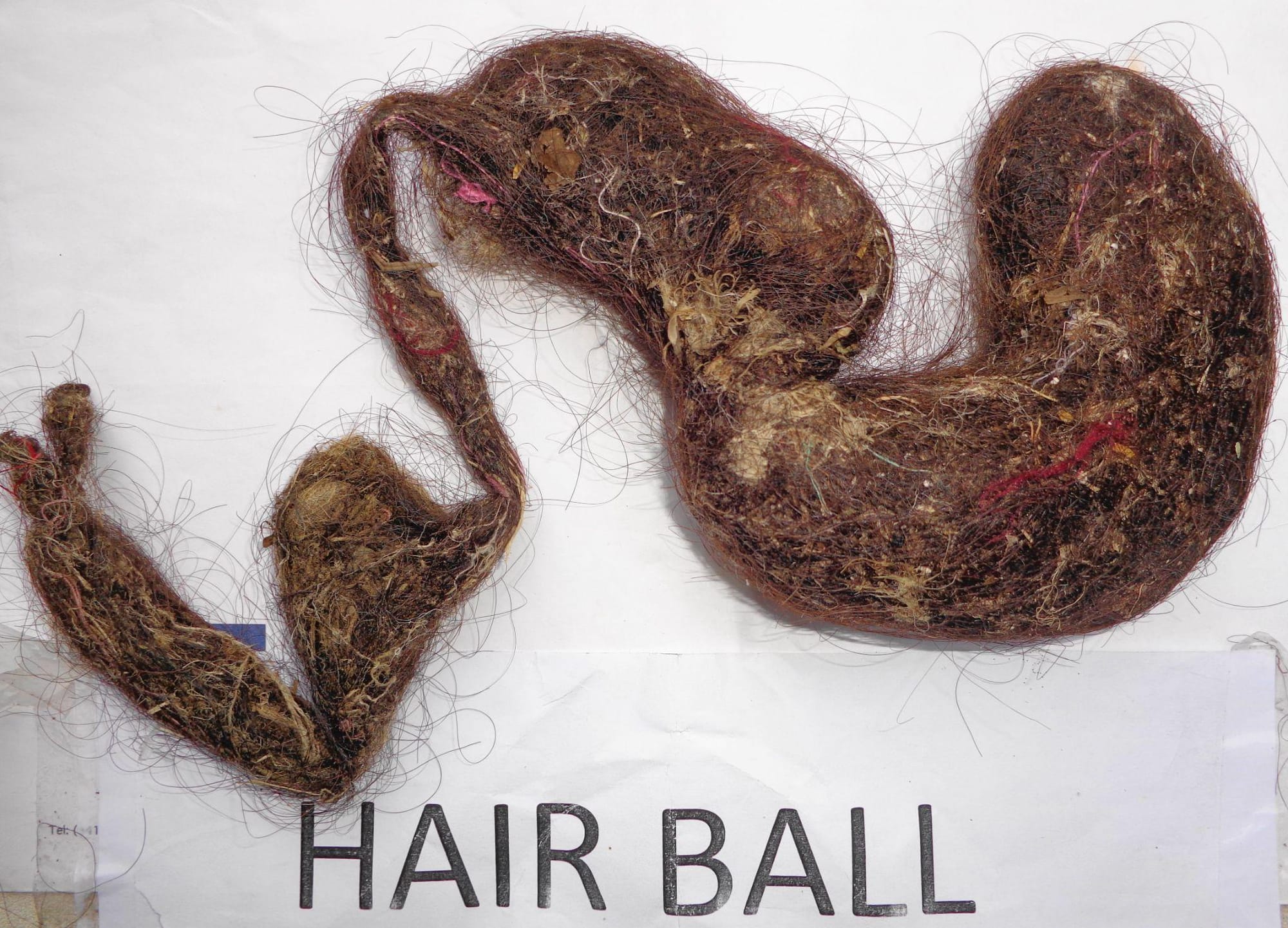 A 700-gram hairball, measuring 75 centimeters long, removed from the stomach of 14-year-old Mali during surgery.