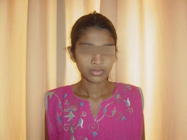 A Hair Ball in a Child’s Stomach: Sri Lanka’s Only Reported Case