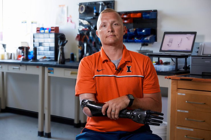 Sergeant Garrett Anderson with Psyonic prosthetic