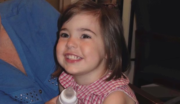 Grace's surgeons used a 3D printer to practice surgery