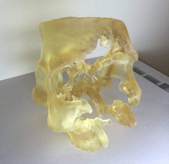Skull-3d-print.png