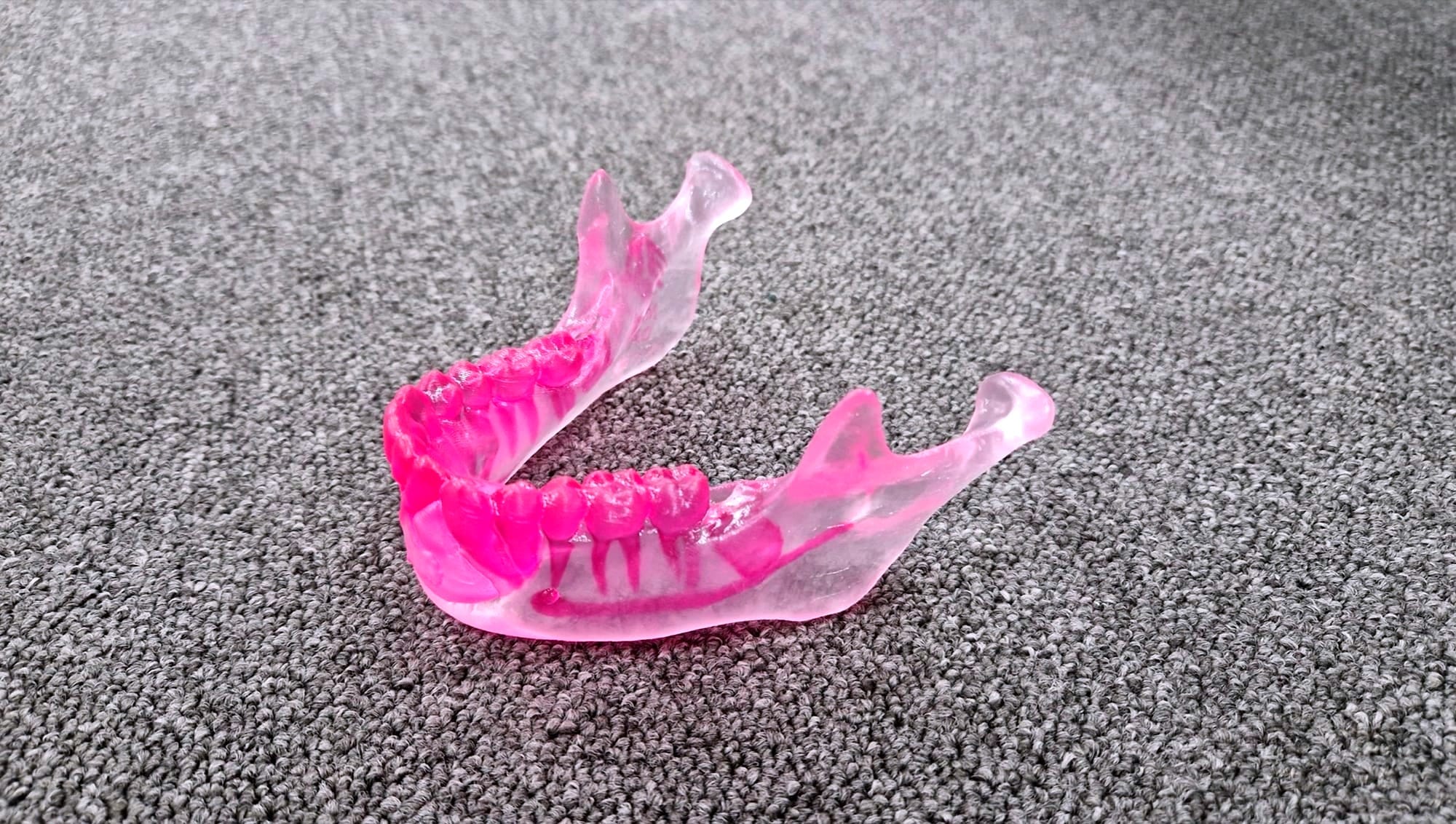 MedScan 3D Wins Pitch Competition for Patient-Specific Anatomical Models