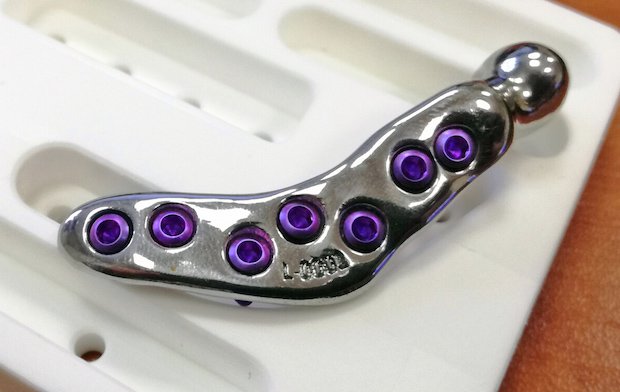 Nikon Metrology jaw implant