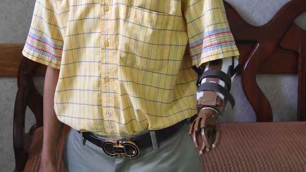 Portland Rotary prosthetics