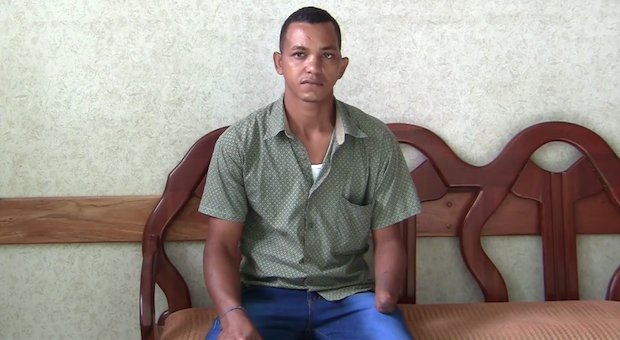 Portland Rotary prosthetics 3.png