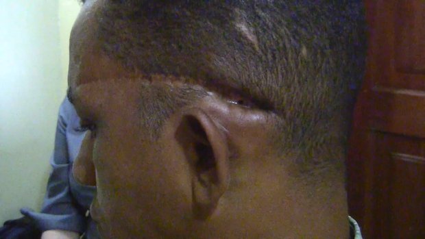 Portland Rotary prosthetics 4.png