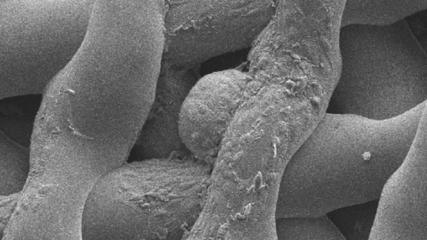 Northwester Uni research ovaries