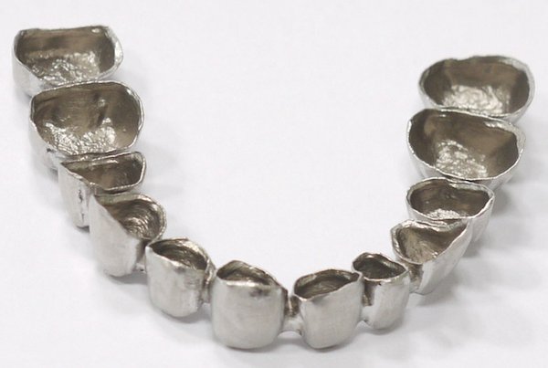 Metal crown printed by Sinterex.jpg