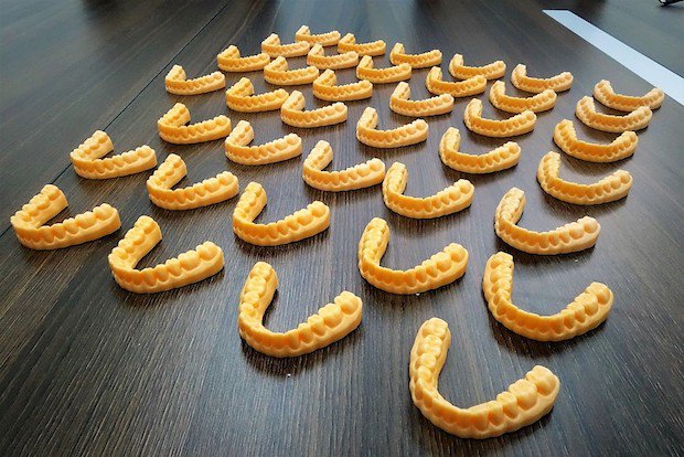 3D printed arches in OrthoPro Peach from Structo.jpg