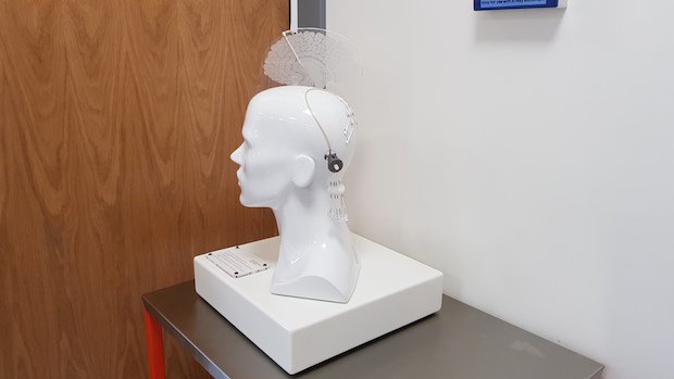 Renishaw drug delivery system Miskin.jpg