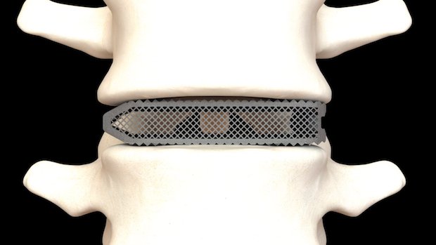 Osseus Fusion Systems