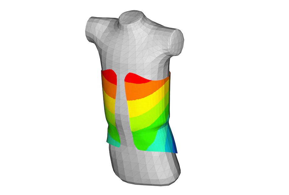 Simulating the deflection of the torso brace in Altair HyperWorks.jpg