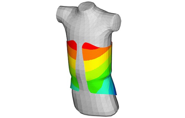 Simulating the deflection of the torso brace in Altair HyperWorks.jpg