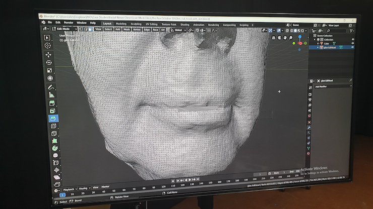 Modelling inside the Artec Studio software. Facial nerve