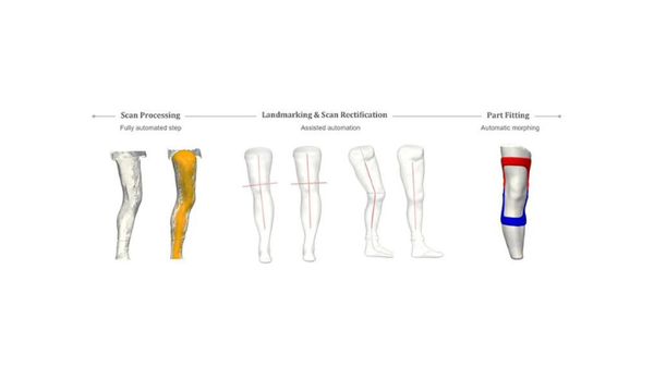BMI Materialise 2.png
