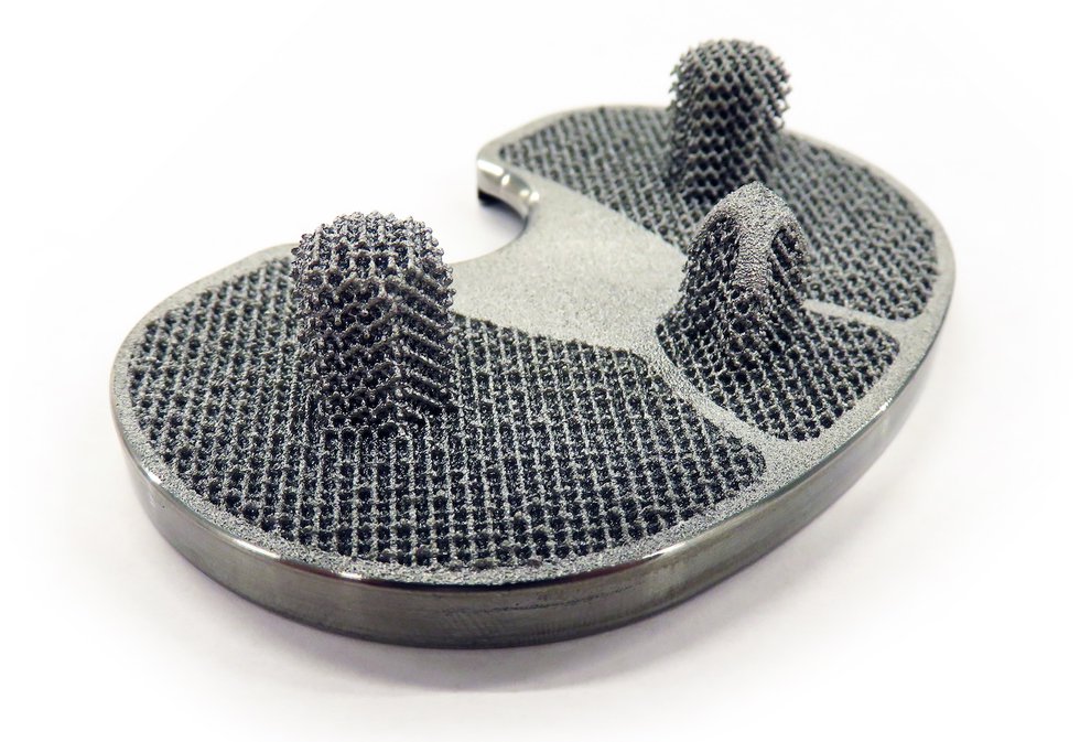 Printed tibial implant