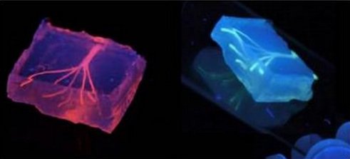 Artificial blood vessels