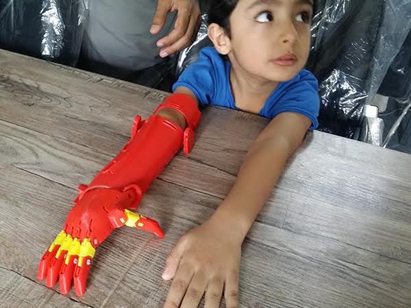 Bioniks 3D arm
