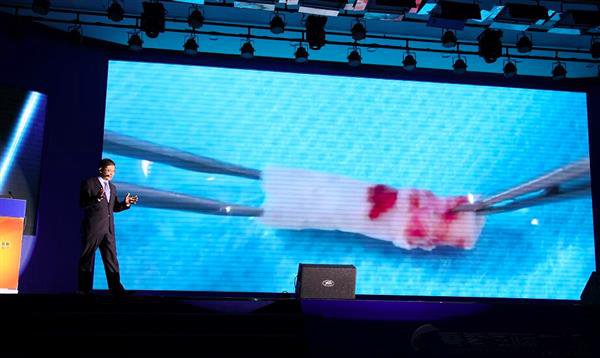 Chinese research blood vessels