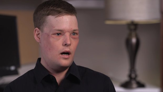 Mayo Clinic Andy Sandness