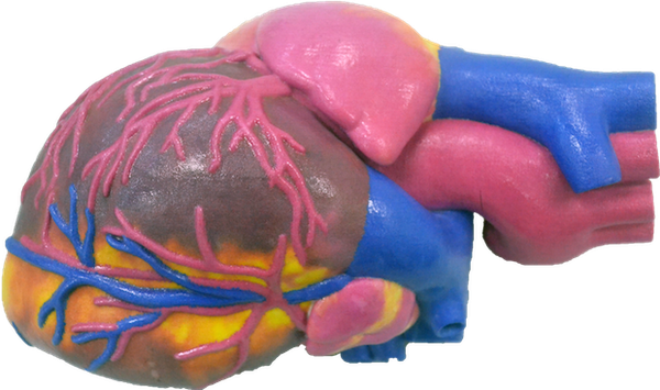 The VA and UW will focus on the treatment of heart disease.
