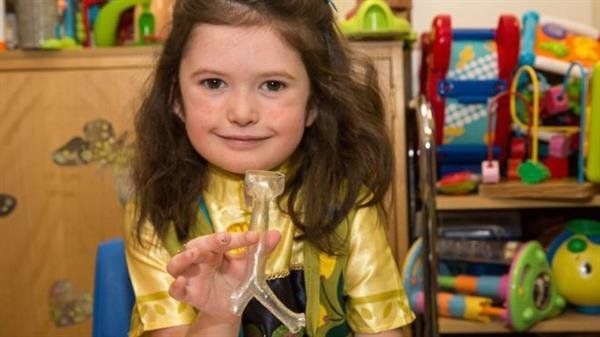 3D printed model trachea used to assist 6-year old's lung surgery to feature at TCT Show