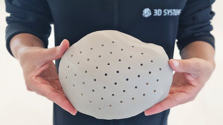 Example of a cranial implant produced using VESTAKEEP® i4 3DF PEEK by Evonik on 3D Systems’ EXT 220 MED extrusion platform. - 3D Systems