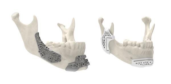 3D Systems