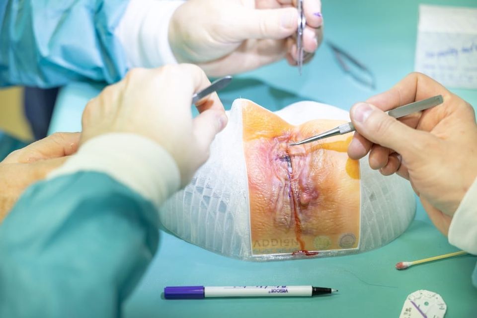 Addion adopts Stratasys Digital Anatomy Solution for 3D printed anatomical eye models