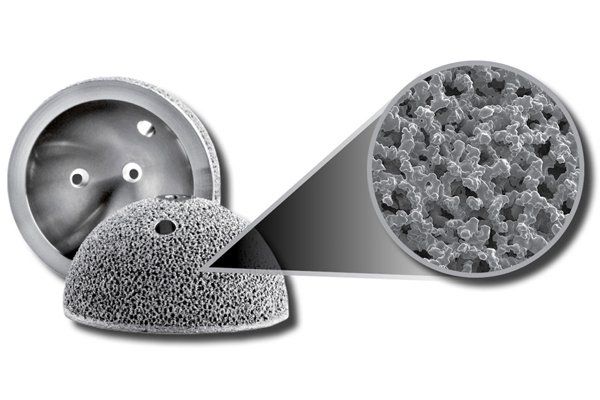 Arcam Orthopedic part