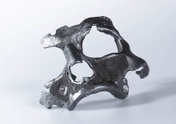 Implant designed using Within Medical for human facial restoration.