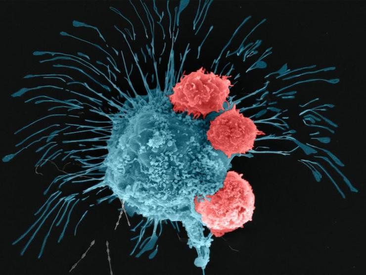 A scanning electron microscopy image shows a breast cancer cell (cyan) being attacked by T cells (red), which were engineered to recognize the cancer cells. - Madhuri Dey, courtesy of the ...