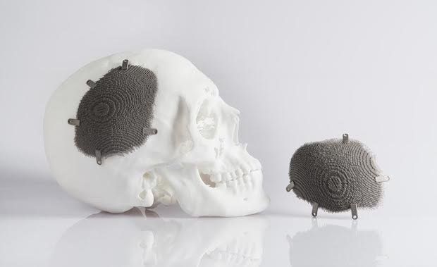 Interview: Shane Fox at Autodesk Within Medical