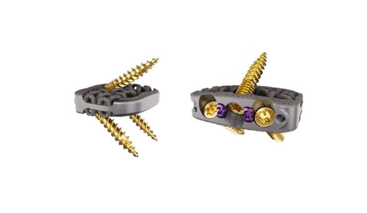 Camber - 1 - Camber Spine Technologies