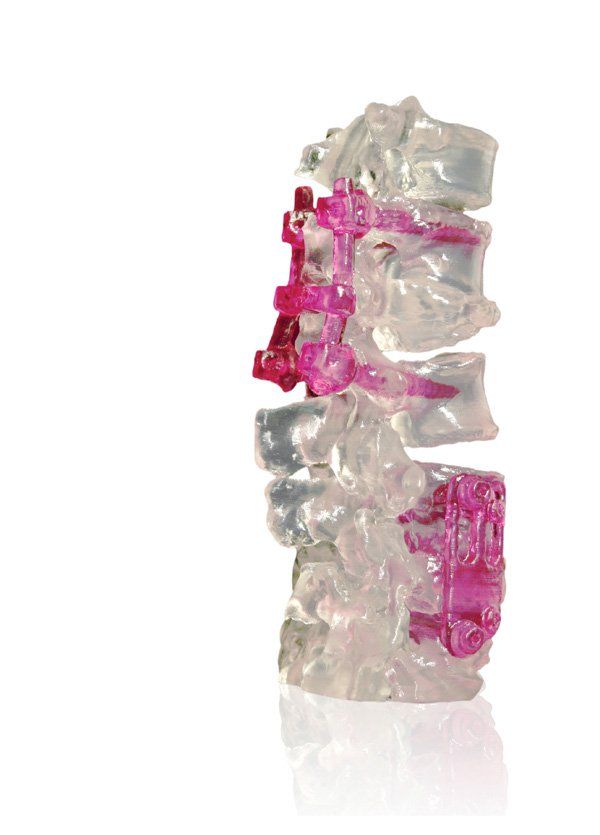 TCT Cover Image 3DS                Biocompatible materials emerged in the mid-1990s and opened up the feasibility of taking these tools into the operating theatre, transforming outputs of ...