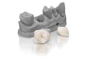 Rapid Shape users to have access to BEGO dental 3D printing materials as companies strike partnership