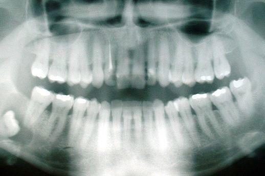 Scheu Dental announce digital orthodontic collaboration - By Pidalka44, via Wikimedia Commons