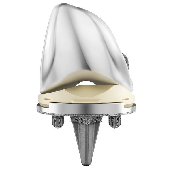DePuy-Synthes-Knee-Replacement                The ATTUNE™ Cementless Fixed Bearing Knee Construct with the AFFIXIUM™ 3DP Technology and ATTUNE™ Medial Stabilized Knee System - DePuy Synthes