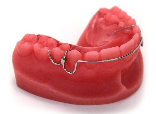 E-Appliance orthodontic model.