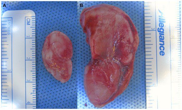 The growth of the 3D printed ear - PLOS ONE
