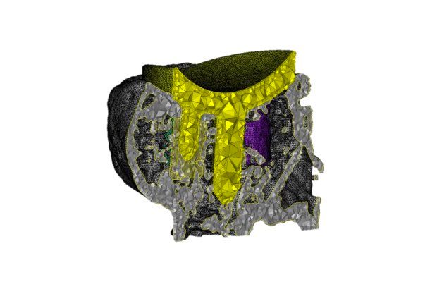 New Mimics Innovation Suite 19 brings easier FEA meshing.