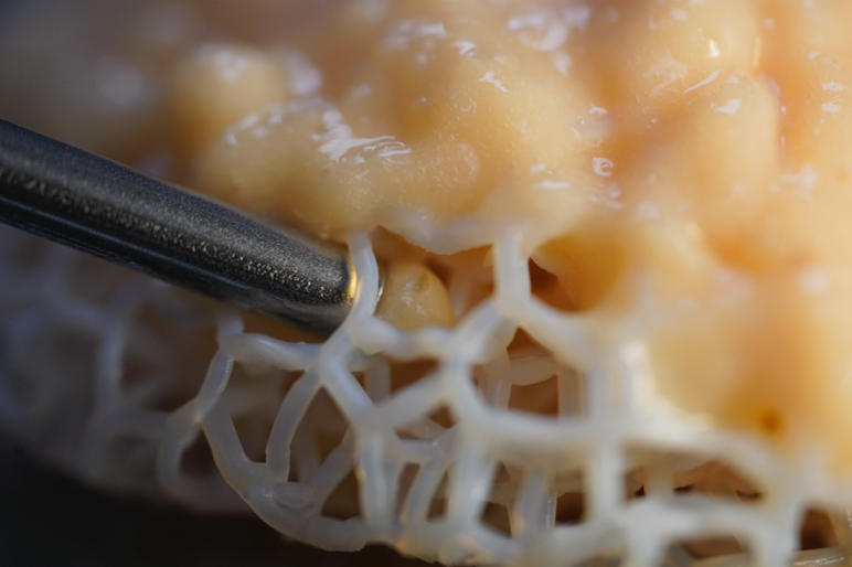 Tiger Aesthetics invests in GenesisTissue to advance personalised 3D bioprinting