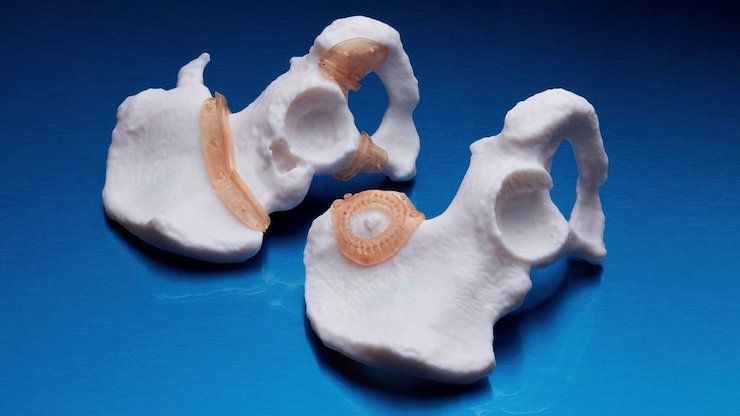 Example of surgical guides that will be made available through RICOH 3D for Healthcare and Insight Surgery partnership. - Insight Surgery