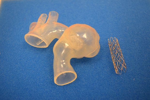 3D printed heart model. - Children's Hospital of Michigan.